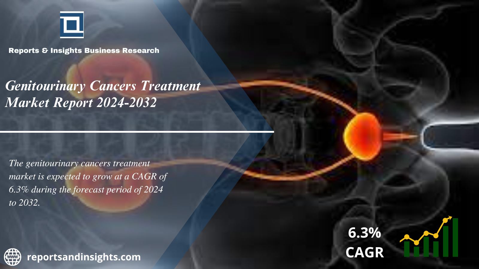 Genitourinary Cancers Treatment Market Report, Size, Share, Trends, Growth, Demand and Forecast 2024 to 2032